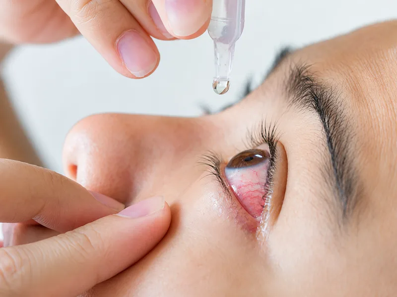 Bên cạnh tìm hiểu đau mắt đỏ kiêng gì, người bệnh nên vệ sinh mắt đúng cách, nghỉ ngơi và sử dụng thuốc theo hướng dẫn.